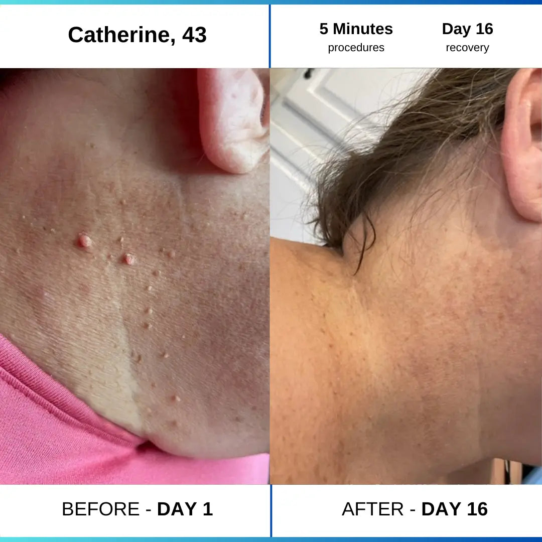OcuraLife before and after result 4